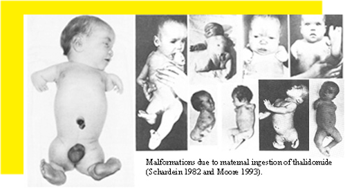 Thalidomide babies